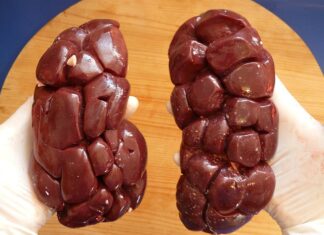 Czy nerka liczy się jako bagaż podręczny Ryanair?